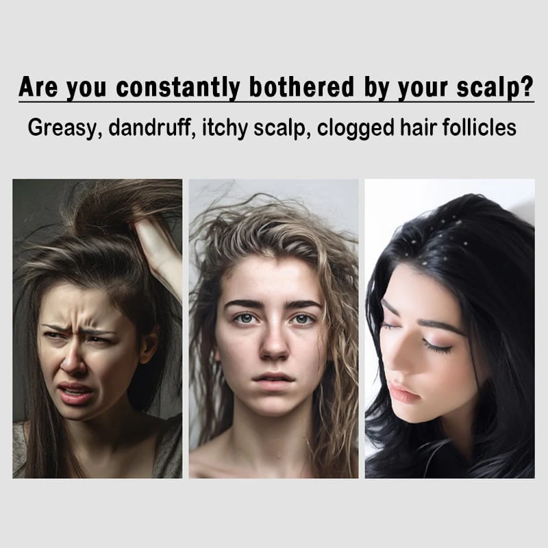 Dandruff Removal Comb - Image 2