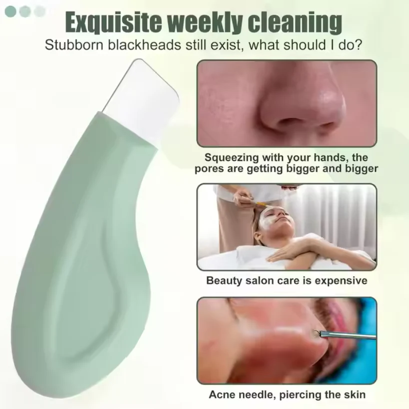 Deep Cleaning Blackhead Remover - Image 5
