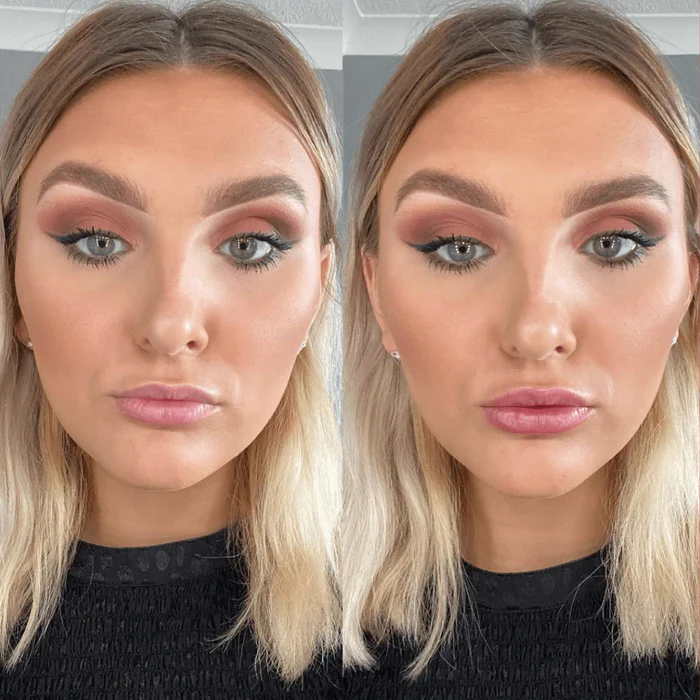 LIP VOLUMIZER - Image 5
