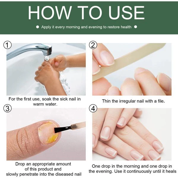 Nail Fungus Solution - Image 2
