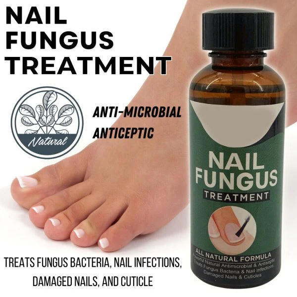Nail Fungus Solution - Image 4