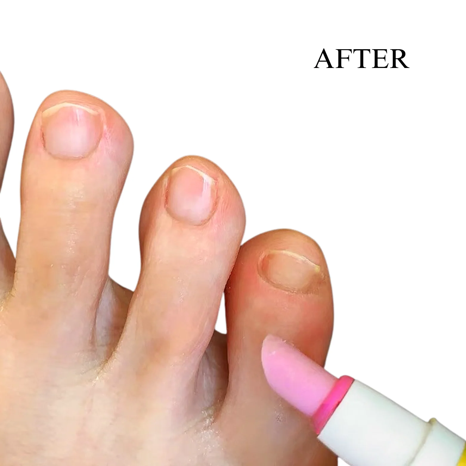 Nail Pusher Pen - Image 6