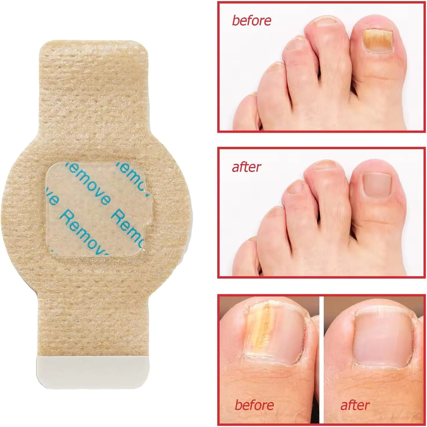 Nighttime Renewal Fungal Nail Treatment Patches - Image 7