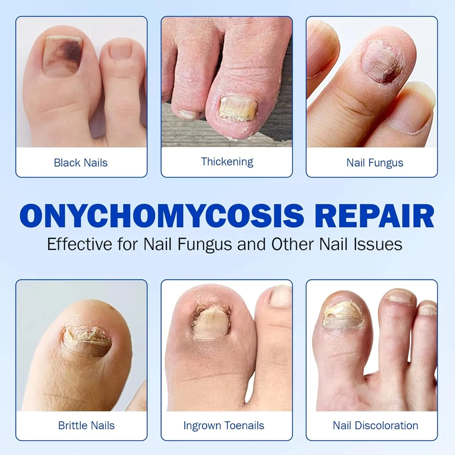 Nighttime Renewal Fungal Nail Treatment Patches - Image 8