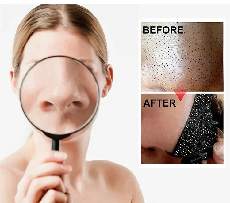 Nose Black Head Remover Strips - Image 2
