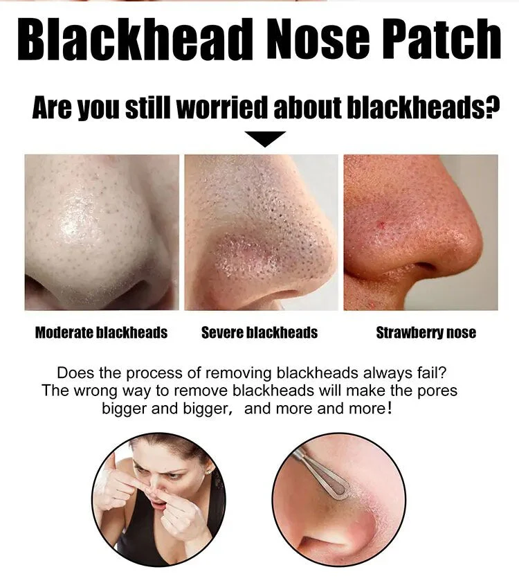 Nose Black Head Remover Strips - Image 3