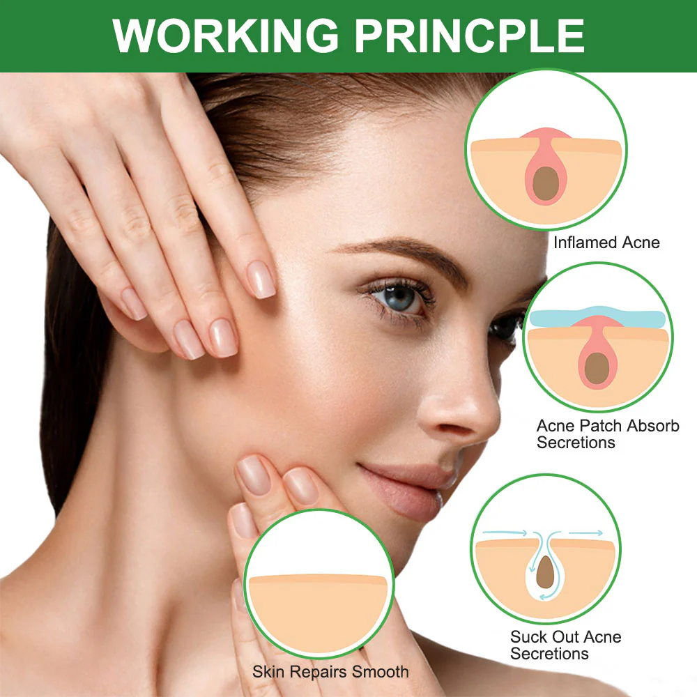 Pimple Patch: Hydrocolloid Acne Treatment - Image 5