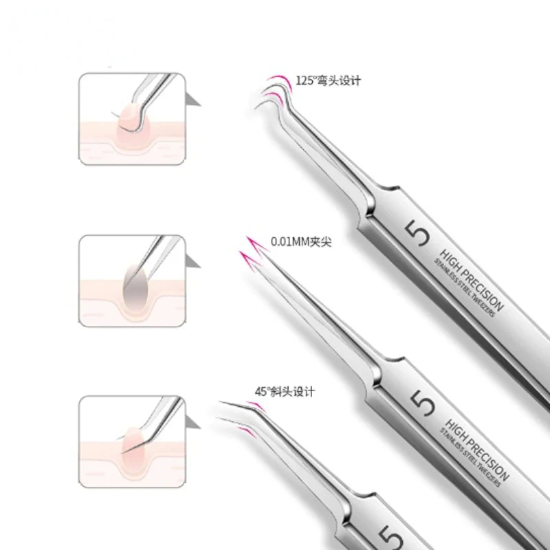 Pimples Blackhead Clip Tweezers - Image 8