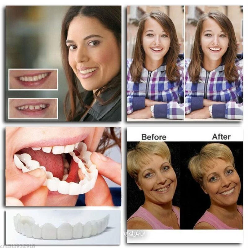 Teeth Denture  (PACK OF 2) - Image 2