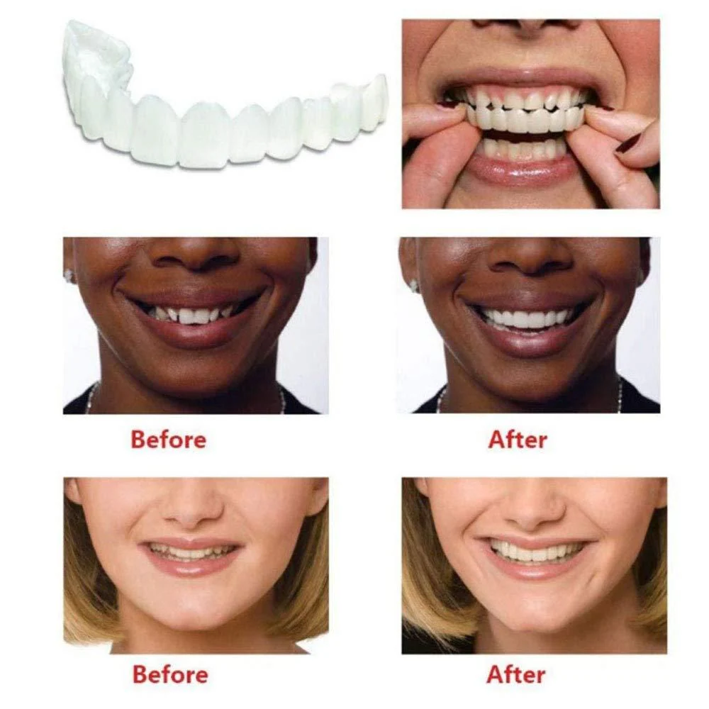 Teeth Denture  (PACK OF 2) - Image 3
