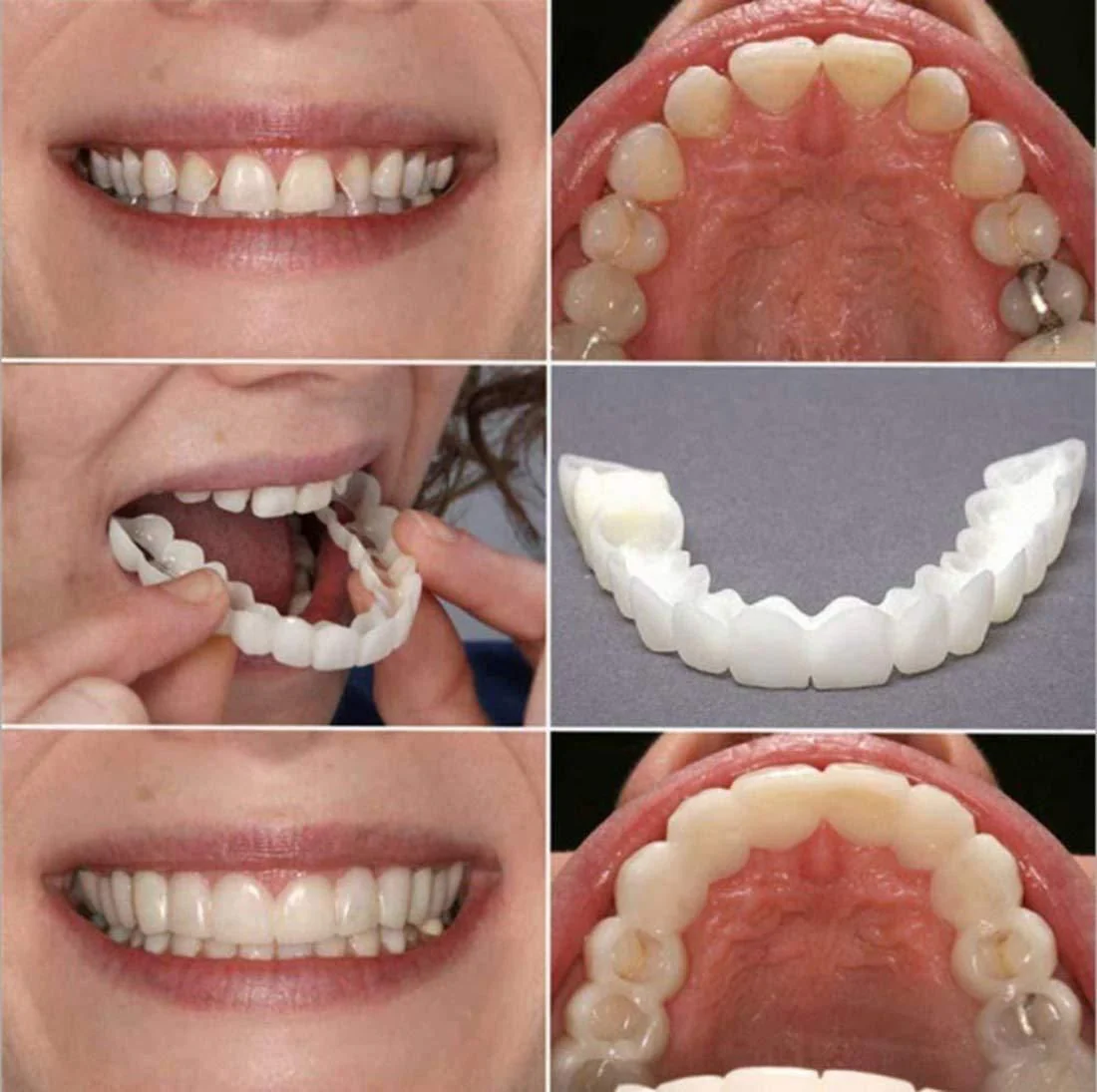 Teeth Denture  (PACK OF 2) - Image 4