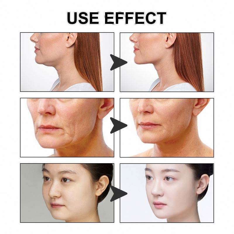 Reusable V-Face Lifting Invisible Tape - Image 5