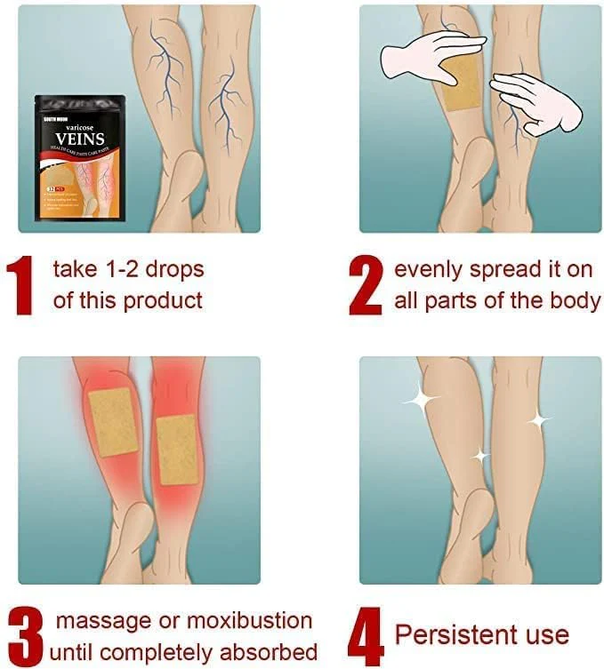 Varicose Veins Patch - Image 3